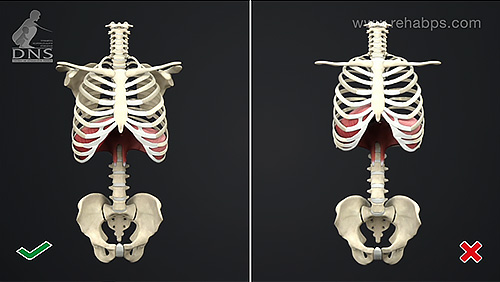 Postural Stabilization – Pathology